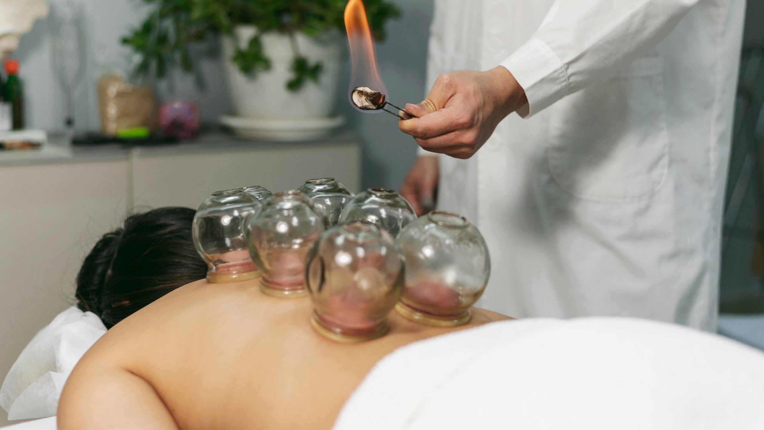 Natural Cupping Therapy ( Hijama)