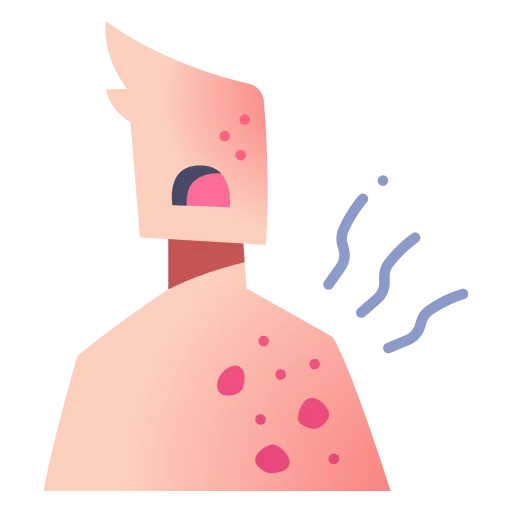 skin-allergy